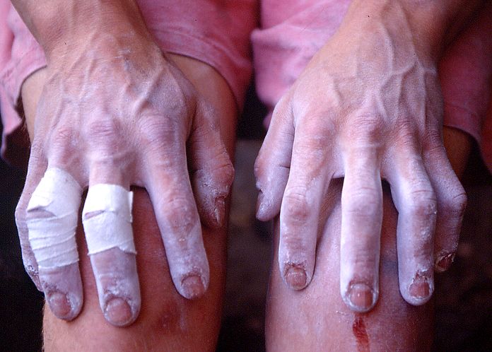 Das Verletzungsrisiko beim Klettern minimieren Das Verletzungsrisiko beim Klettern minimieren